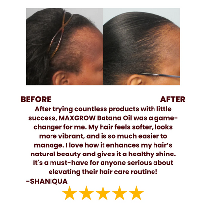 Authentic Honduran Batana Growth Oil